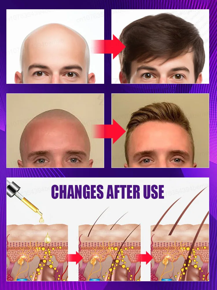 Designed specifically for those suffering from hair loss，No Add chemical stimulation