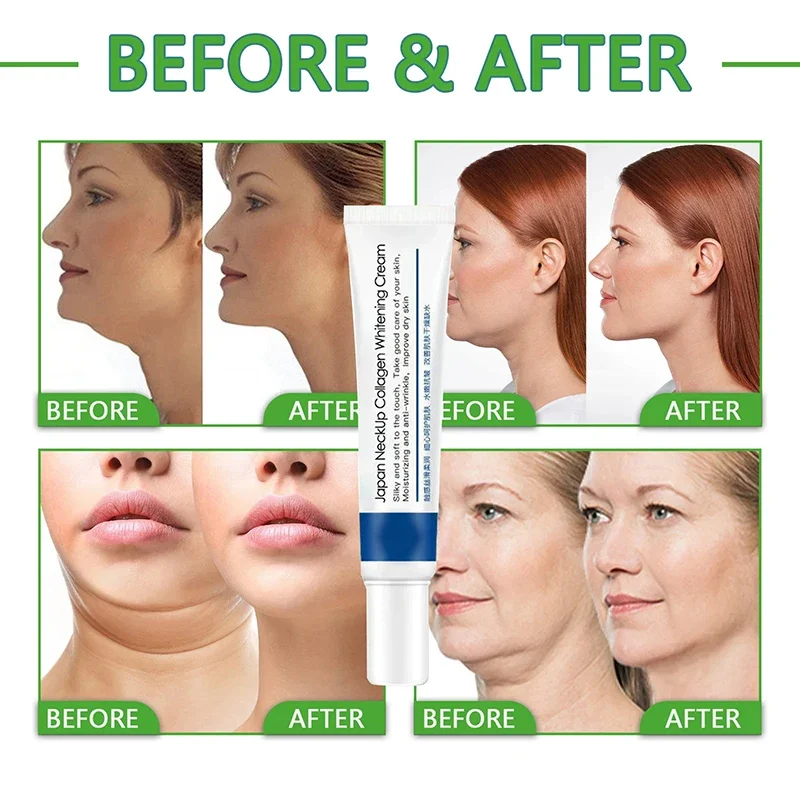 Neck Cream Eliminate Neck Lines Protein Cream Eliminate Double Chin Lift Neck Fine Lines Anti-ageing Moisturis Nourish Beauty Health