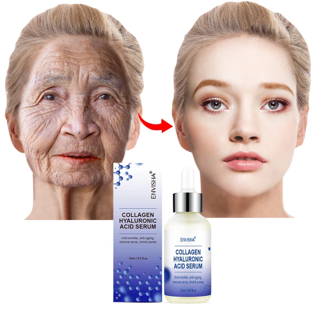 Envisha Arcbőrápolás Kollagén Hialuronsav Szérum Retinol-Vitamin Öregedésgátló Ráncok Hidratáló Fehérítő Zsugorodó Pórusok - Image 3