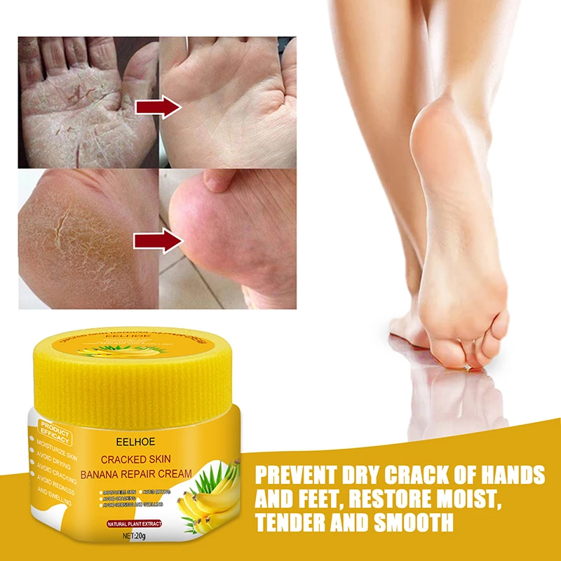 Certificaat kolf glas 20g Foot Dead Skin Remover Banana Oil Anti-drying Crack Foot Cream Cracked  Heel Repair Hand Foot Care Cream Tslm1 - Feet Care - AliExpress