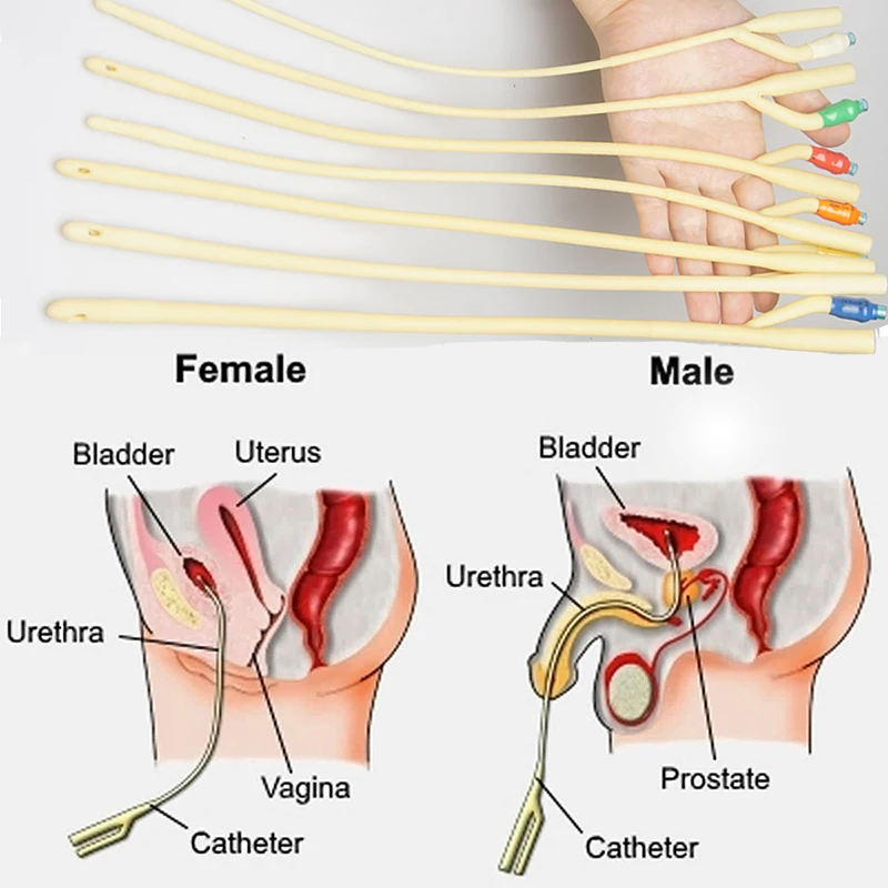 Penis Plug Urethral Sounding Bladder Dildator Catheter Sound Dilation Urethra Probe