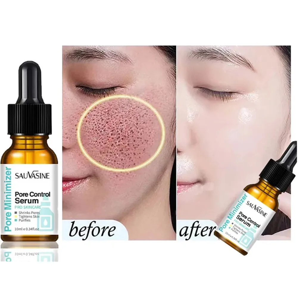 Pore Shrinking Face Serum Remover Blackheads Dark Spots Acne Treatment Oil Control Moisturizing Improve Dull Smoothing Skin Care