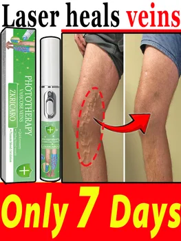 Laser vein Hot selling