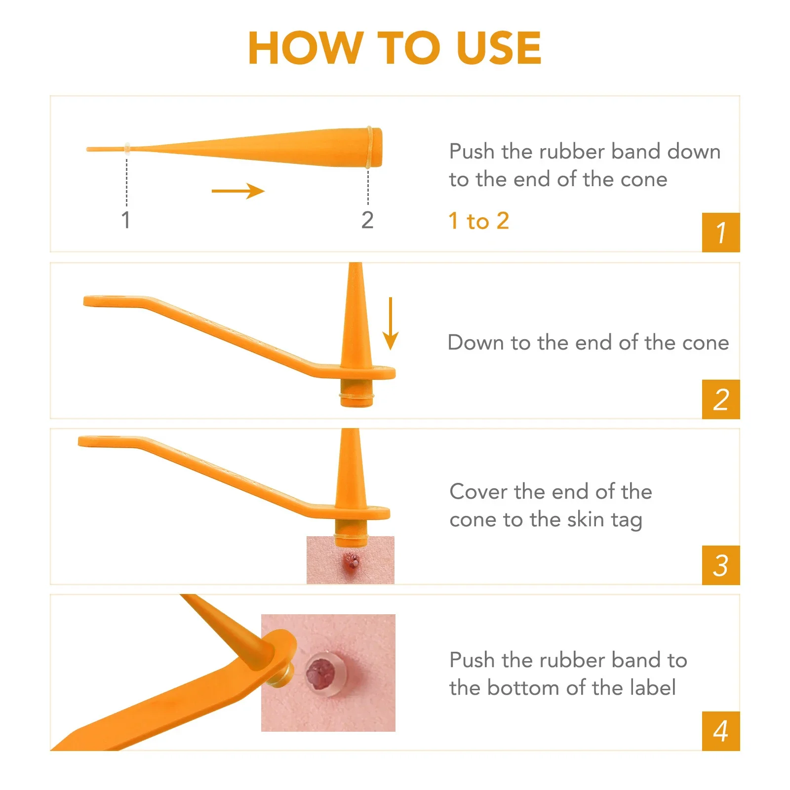 Simple Wart Removal Tool Set Skin Tag Removeal Tool Easy To Clean Skin Care Tag Removal Care Products skin tag removal tool