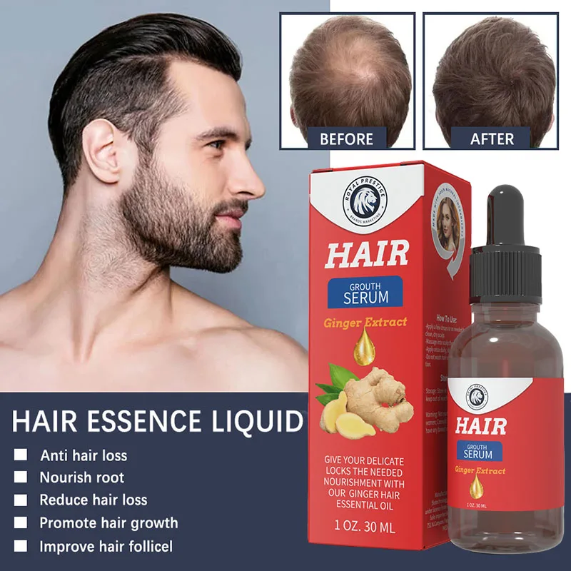 HairGrowthProductsforManWomenGingerAntiHairLossFastRegrowth