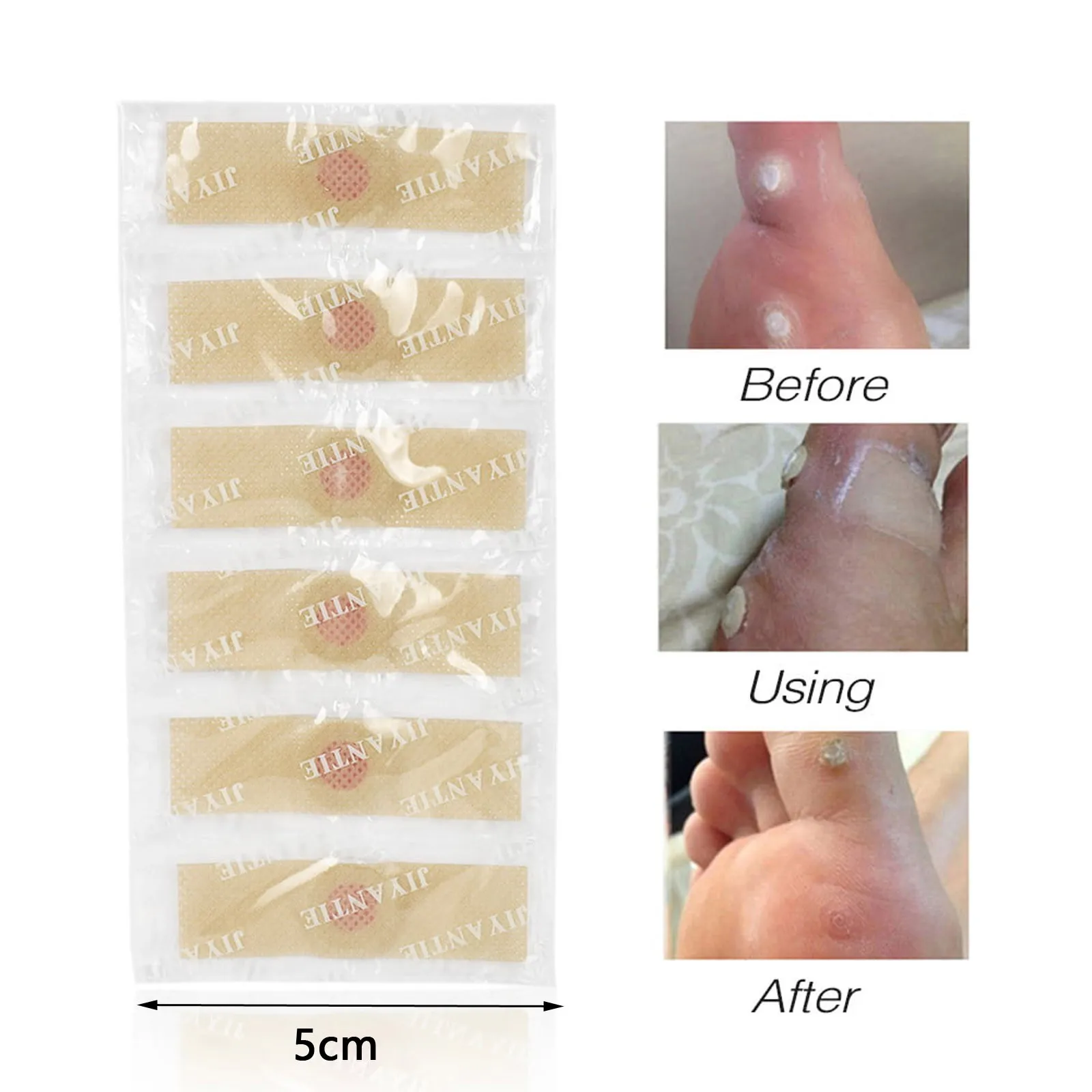 Foot Corn Removal Plaster With Hole Wart Thorn Paste Foot Callus Removal Paste Toe corns removal plaster Foot Corn Removal Plaster