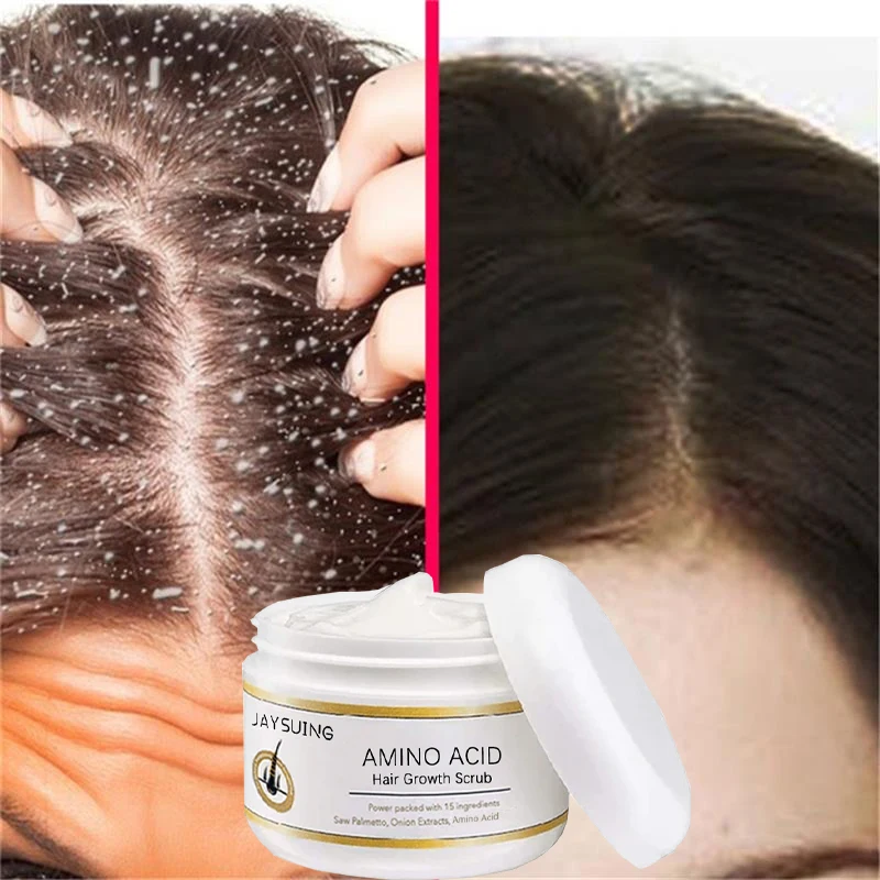 

Fast Anti Exfoliating Scrub Remove Dandruff Anti Itching Treatment Seborrheic Scalp Oil Control Cleansing Repair Scalp Care 50g