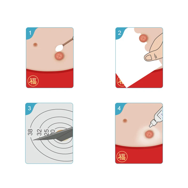 Durable Colostomy System:Drainage 10pcs Colostomy Bag Stoma Care Bags With Carbon Filter High Quality