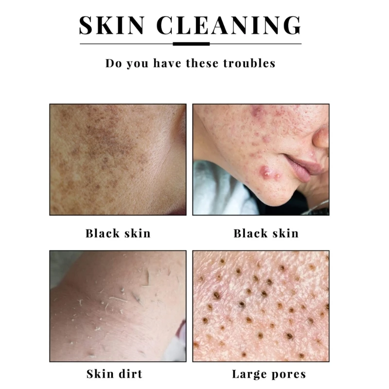 Рисунок 4 - Упаковка из 3 мыл с койевой кислотой