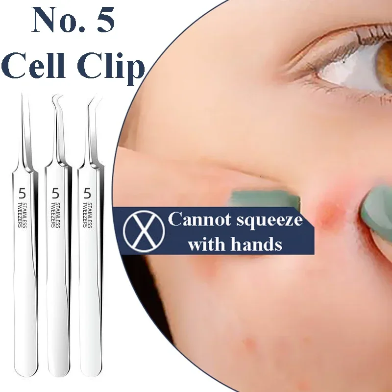 Ultra-fine No. 5 Cell Clip Set With Box Pimples Blackhead Clip Tweezers Special Scraping & Closing Acne Home Cleaning Skin Tools tweezer tool,pimples blackhead tweezers,blackhead clip tweezers,cosmetic tool