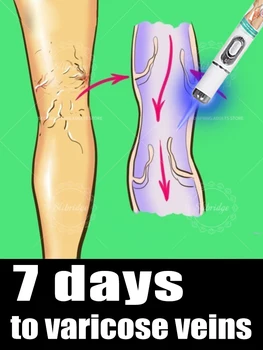 Improving Blood Circulation 1