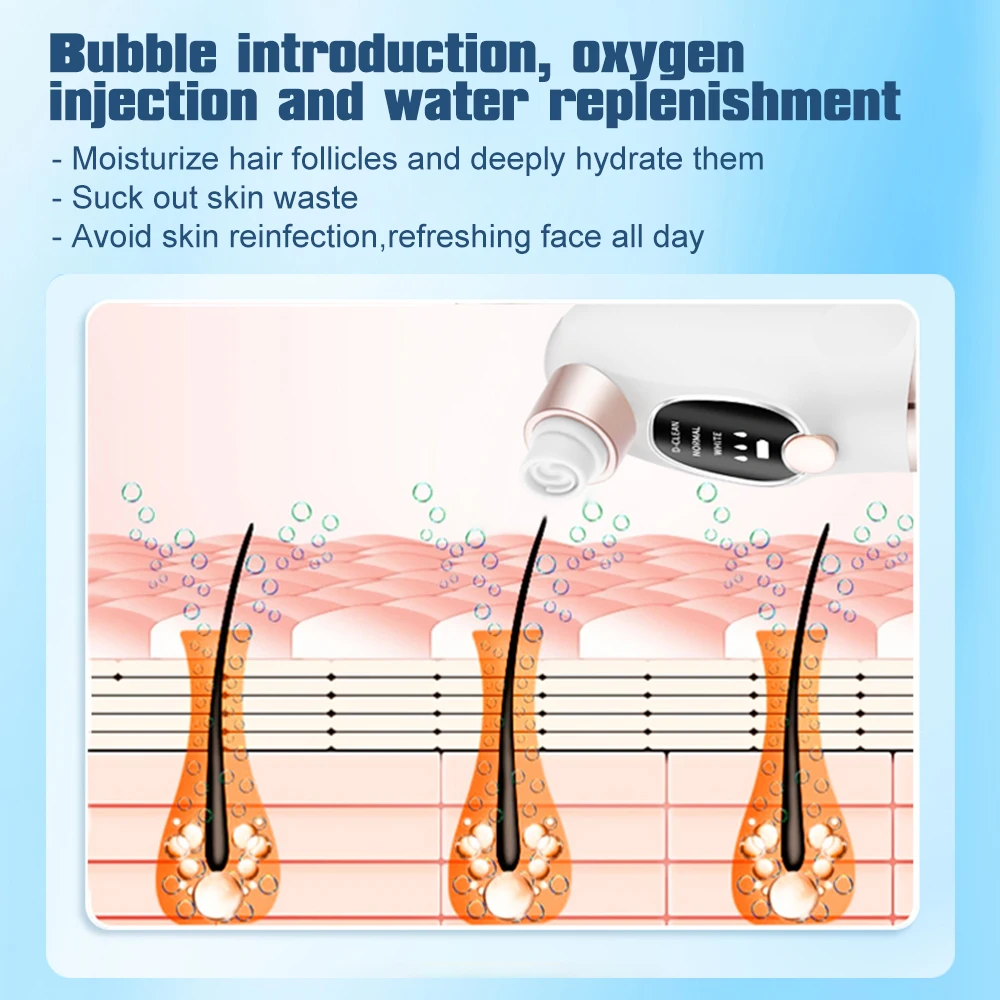 Blackhead Remover Pore Vacuum Face Cleaner Electric Pimple Acne Black Head Removal USB Rechargeable Water Cycle Black Dot Remove