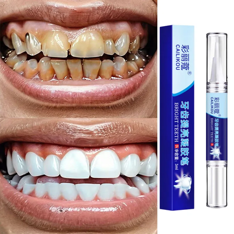 Teeth Whitening Toothpaste Serum Pen Remove Plaque Stains Oral Hygiene Cleaning Dental Bleaching Tools Fresh Breath Tooth Care
