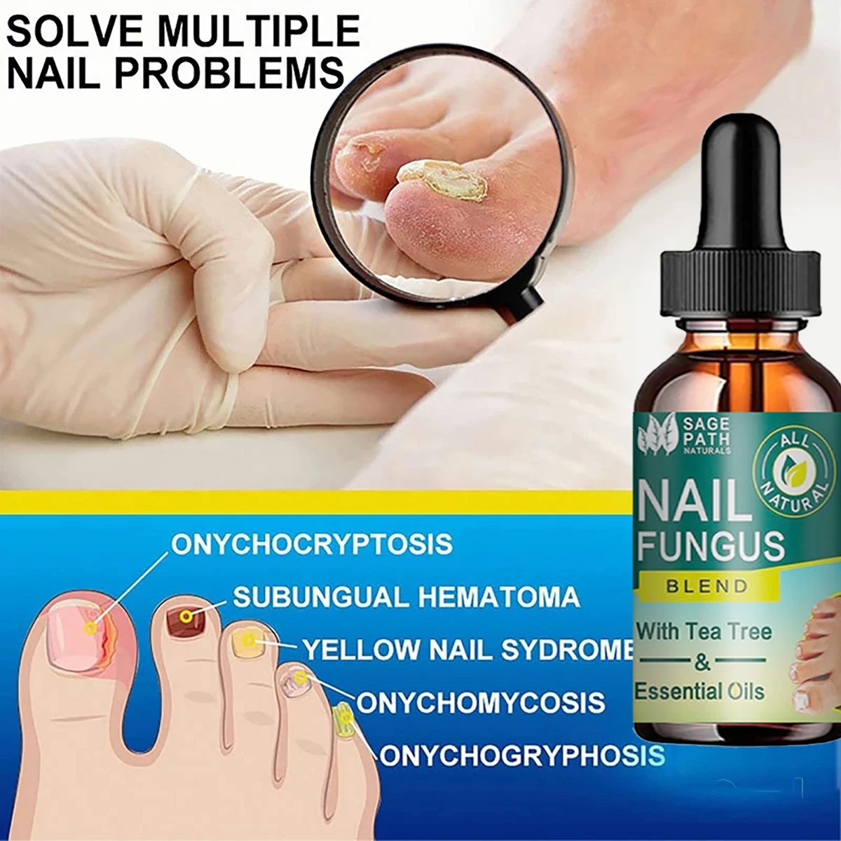 7DAYS Repair Nail Fungus Treatments Essence Foot Care Serum Toe Nails Fungal Removal Gel Anti-Infection nail care essence