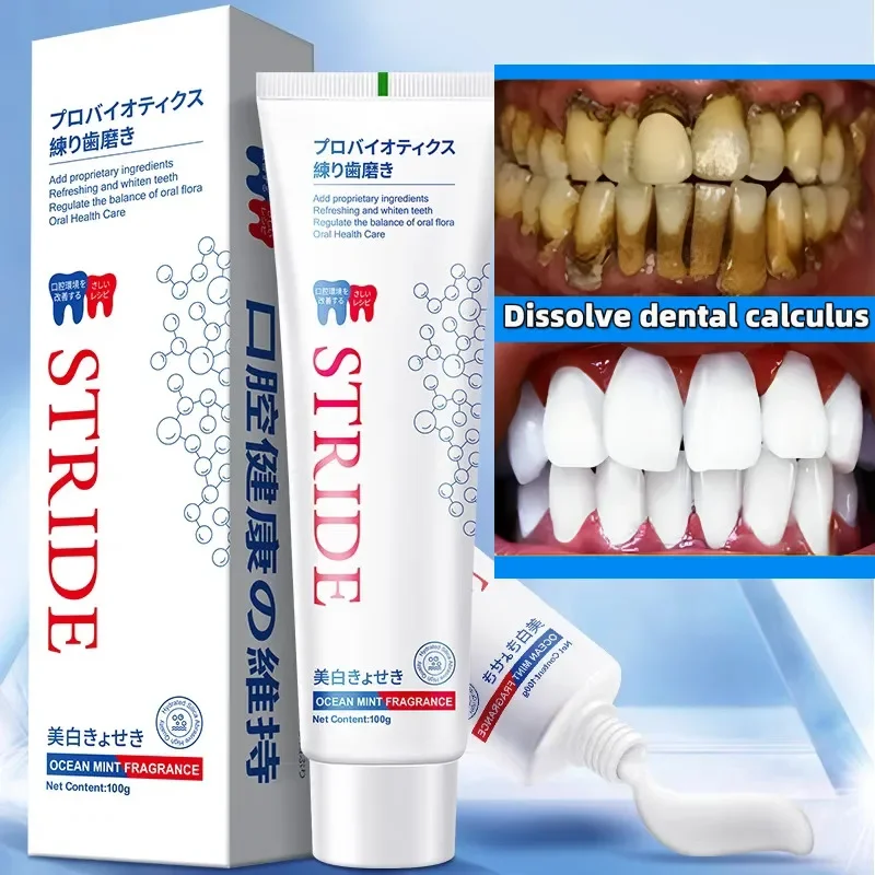 Dental Calculus Remover Removal Bad Breath Teeth Whitening Toothpaste Brightening Preventing Periodontitis Dental Cleansing Care