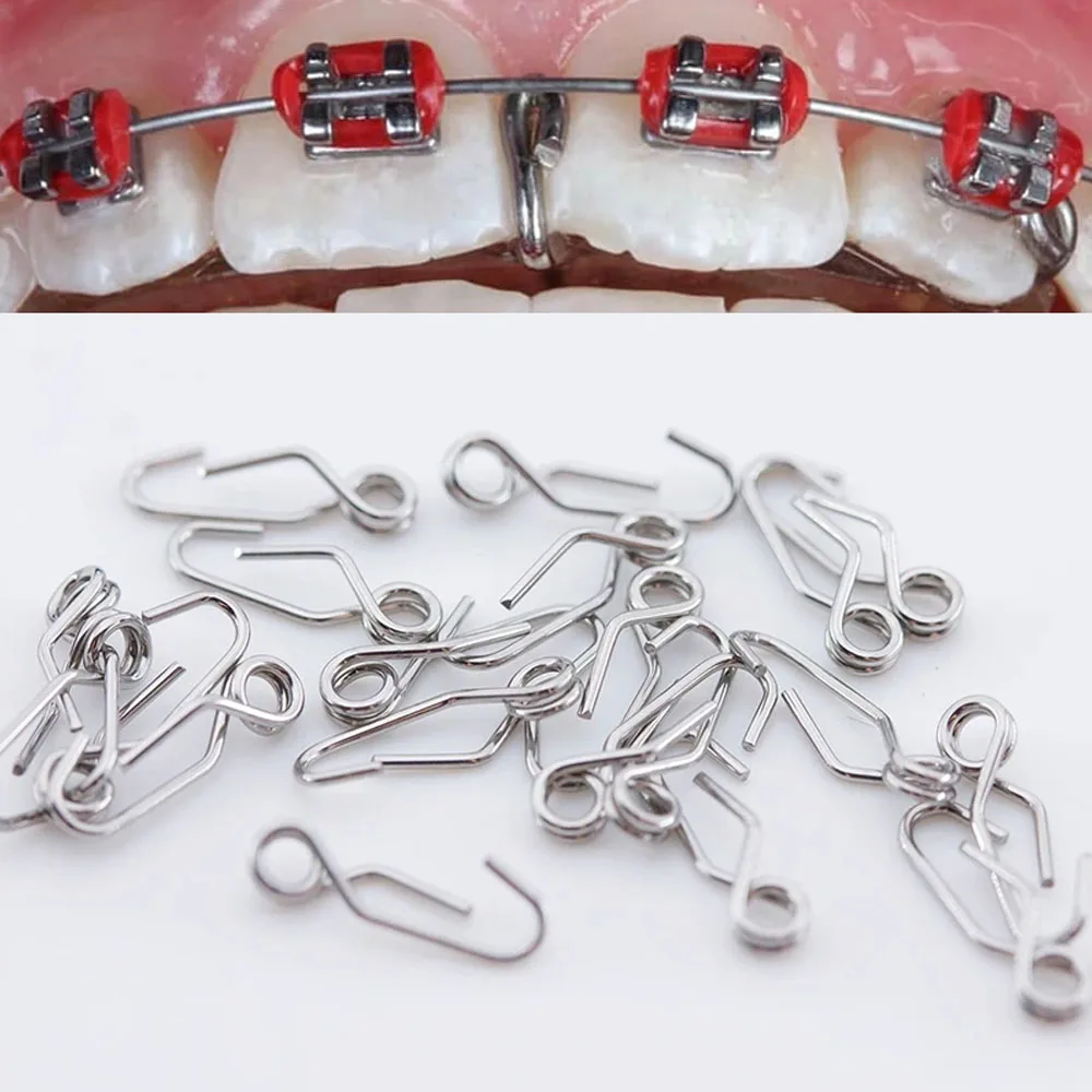 歯科 セパレーター 歯科 セパレーター file.jpg