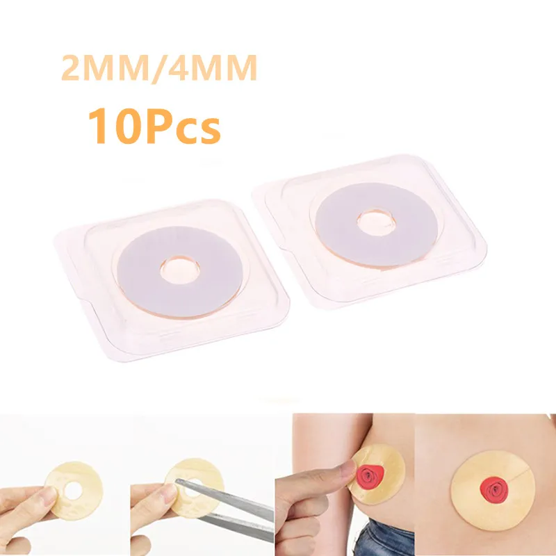 Anti-Leakage Ring 10Pcs For Colostomy Bag Ostomy Paste Ring Baseplates Stoma Care Products To Protect Skin