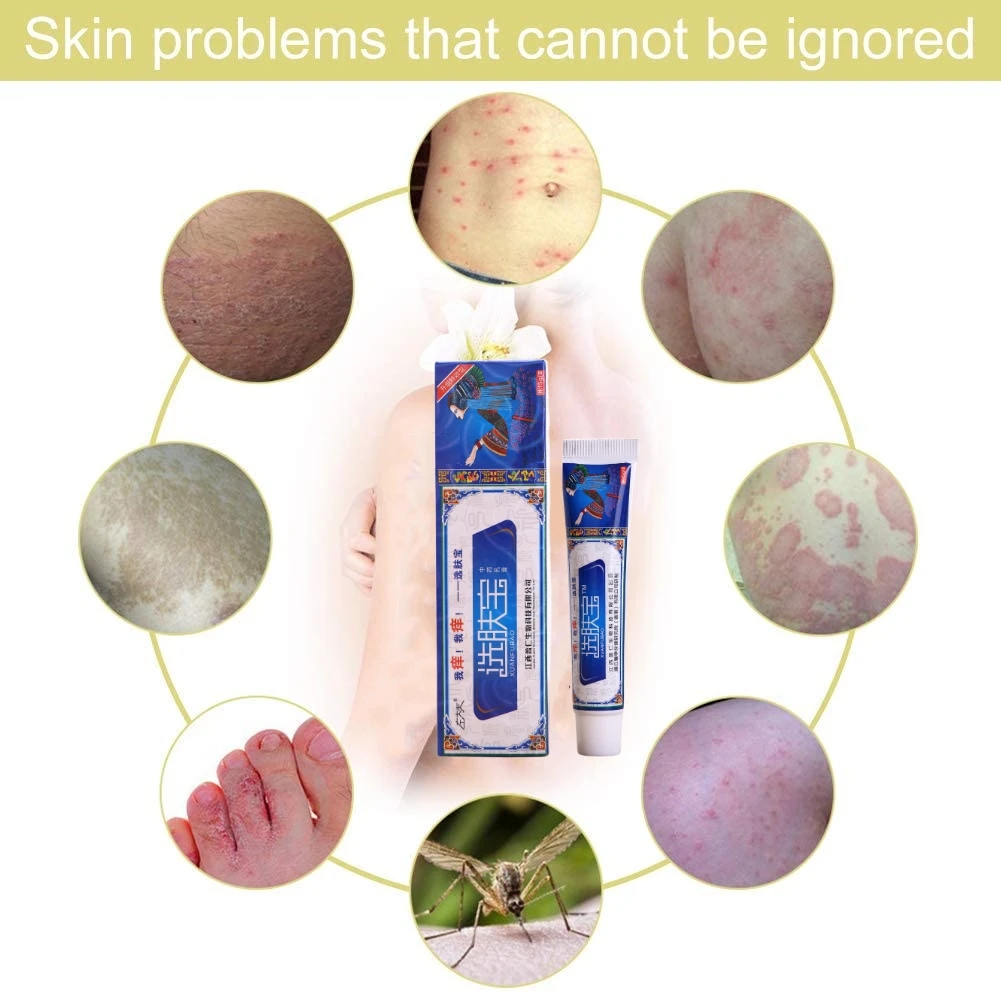 Natural Chinese Herbal Eczema Psoriasis Cream Dermatitis And Eczema Pruritus Psoriasis Ointment Healthy Skin Care