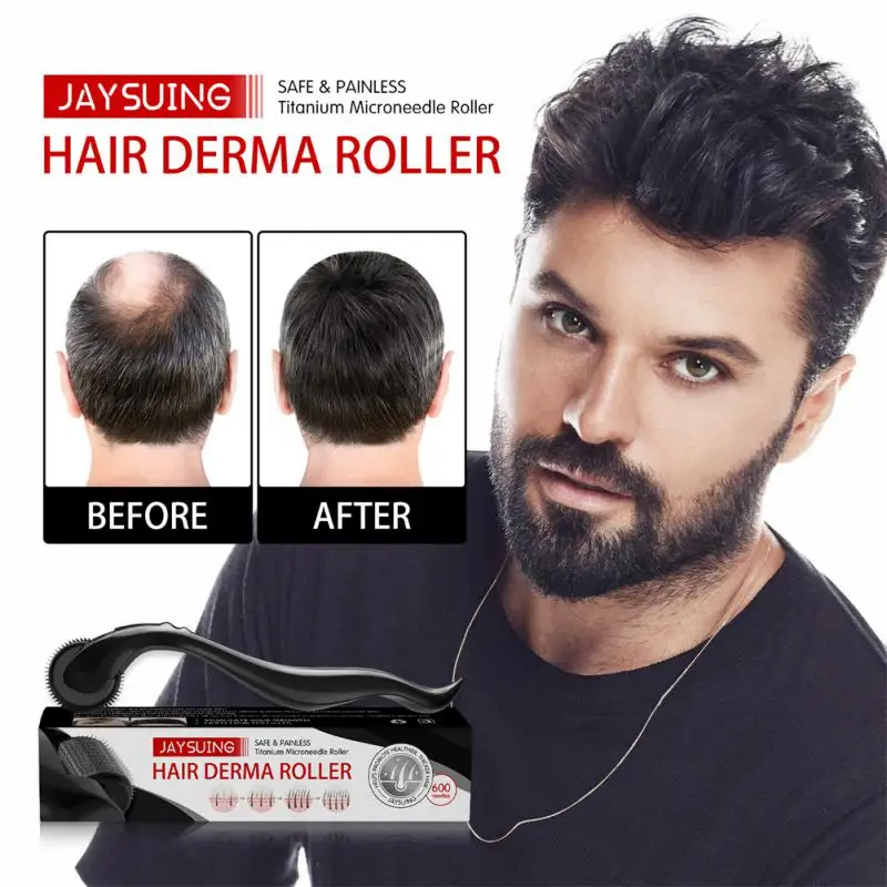 1Pcs Micro Needle Roller Derma Roller Dermaroller Titanium Hair Regrowth  Beard Growth Anti Hair Loss Treatment Thinning Receding| | - AliExpress