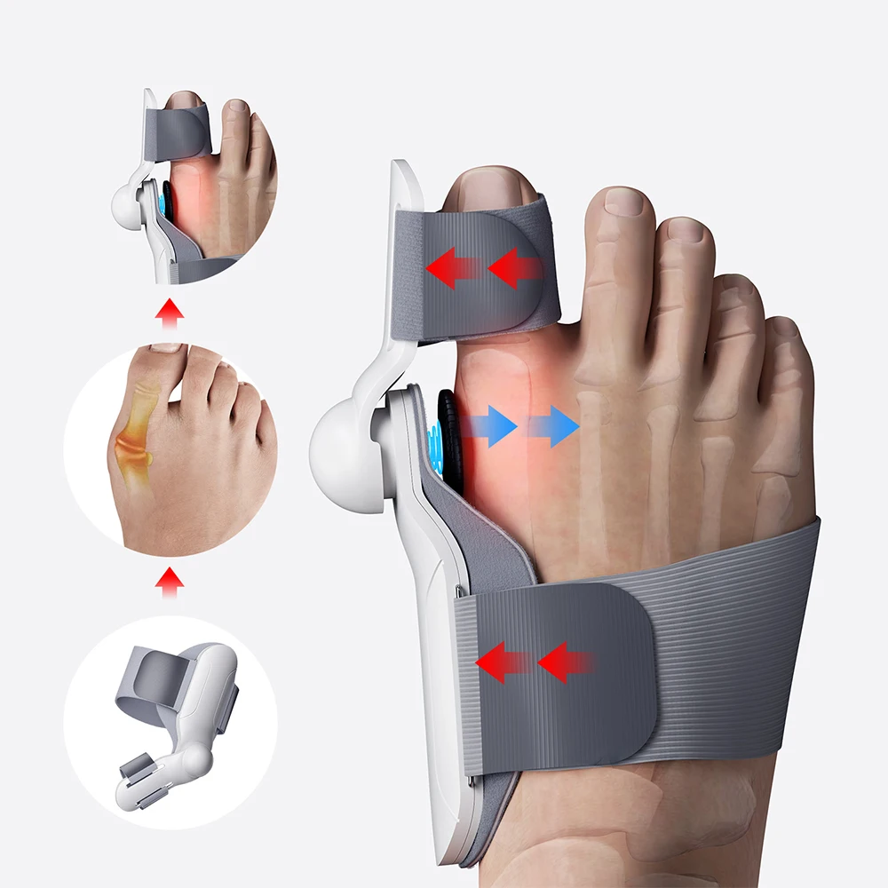 Big Toe Separator Hallux Valgus Bunion Corrector Orthotics Feet Bone Finger Correction Pedicure Adjustable Finger Straightener