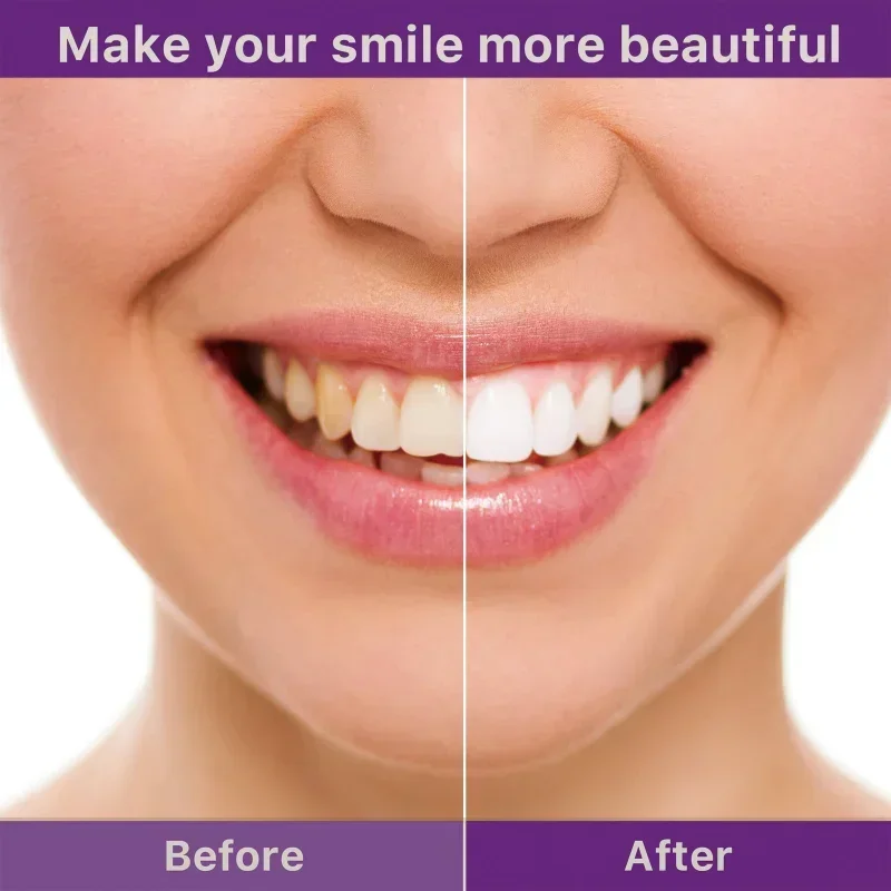 Teeth Cleansing Whitening Toothpaste Clean Yellow Tooth Tartar Removes Cigarette Stains Hyun White Oral Hygiene For Adults