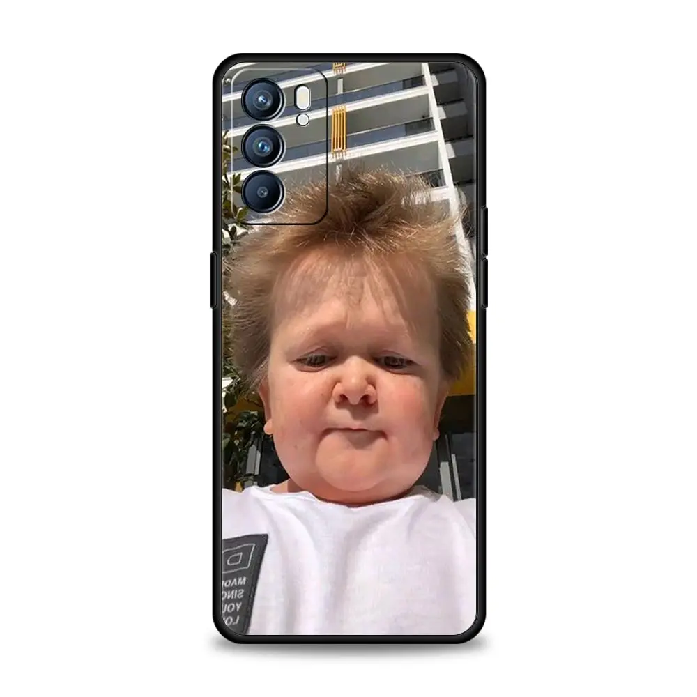 Humorous Hasbulla Phone Case - Stylish and Durable Cover