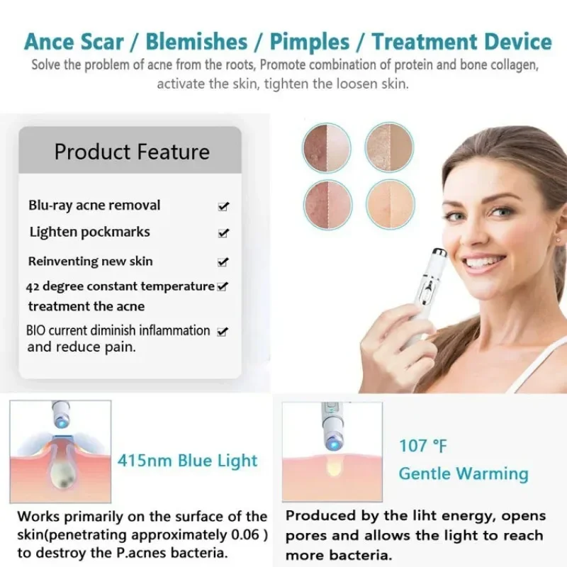 Acne Wrinkle Removal Laser Pen Skin Spots Removal Anti Varicose Spider Vein Treatment Medical Blue Light Eye Massage Instrument plasma pen remover,blue light therapy pen,laser plasma pen remover,laser pen therapy,skin care device