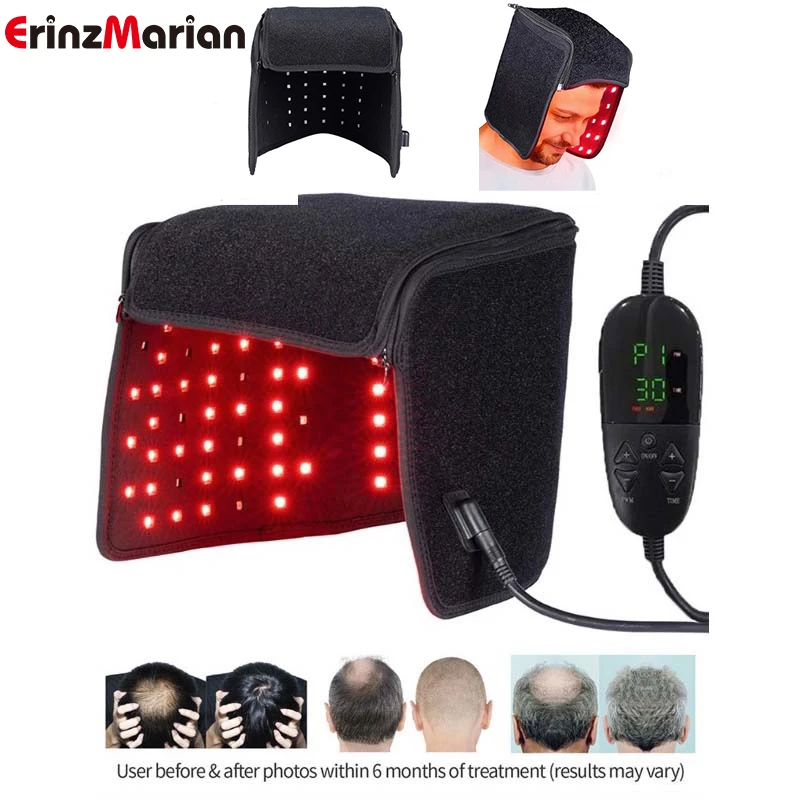 Red Light Therapy Hat For Hair Regrowth, Infrared Light Therapy  Captreatment For Thinning Hair Comb,migraine Relief Cap - Hair Growth  Devices - AliExpress