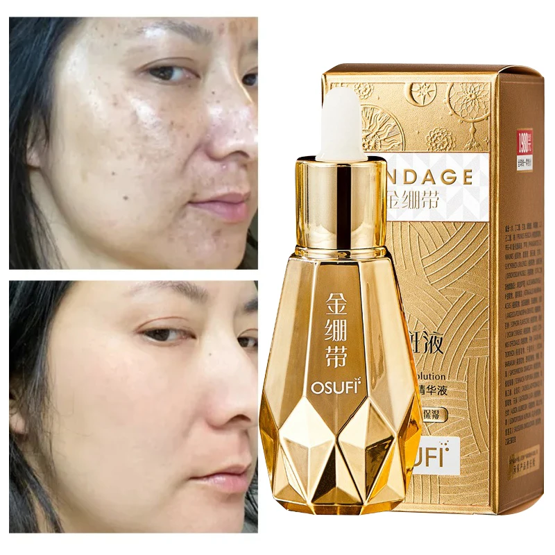 Whitening Freckle Removing Serum Black Spots Melasma Acne Marks Brightening Reduce Pigmentation Correcting Facial Skin Care 60ml kem hà kiều anh mẫu mới tem mới nhất 50g whitening prevent black spot and freckles brightening anti aging tightening pores