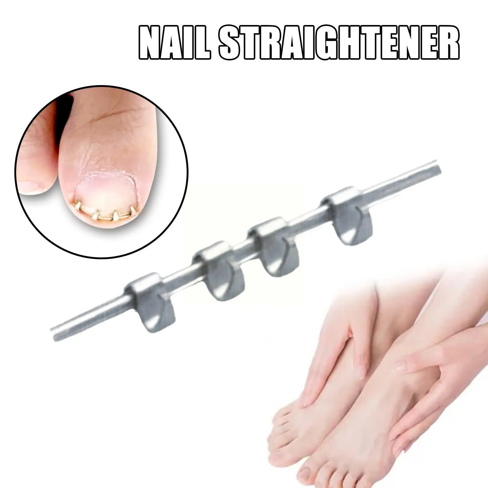 1Pc Ingrown Toe Nail Correction Wire Fixer Treatment Paronychia
