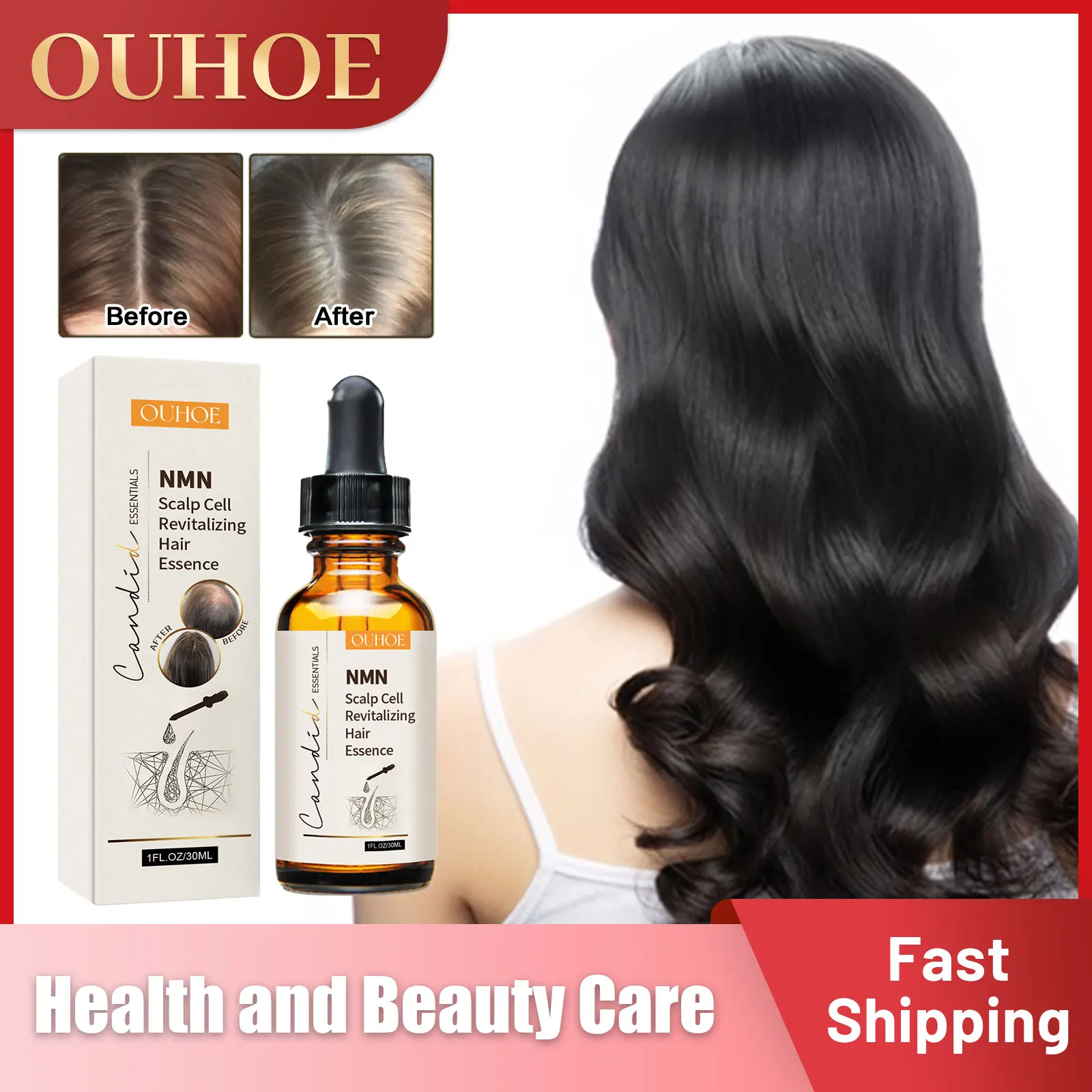

Hair Growth Essence Anti Hair Loss Baldness Alopecia Repair Hereditary Postpartum Seborrheic Scalp Treatment Serum Beauty Health