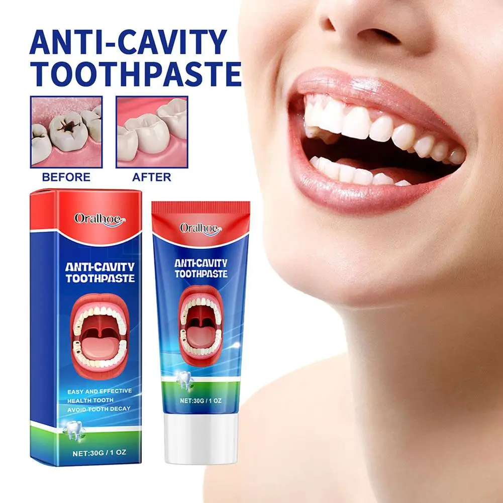 Anti Decay Toothpaste Dental Caries Repair Cream Prevent Tooth Decay Protect Teeth Remove Plaque Toothache Relieve Periodontitis teeth health product