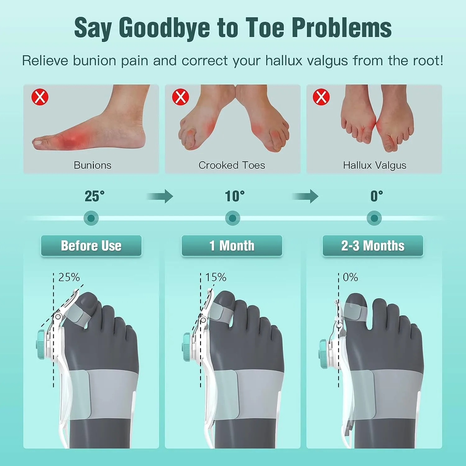 Bunion Toe Corrector For Women Men Big Toe Orthopedic Toe Straightener Anti-slip Heel Strap For Left & Right Feet