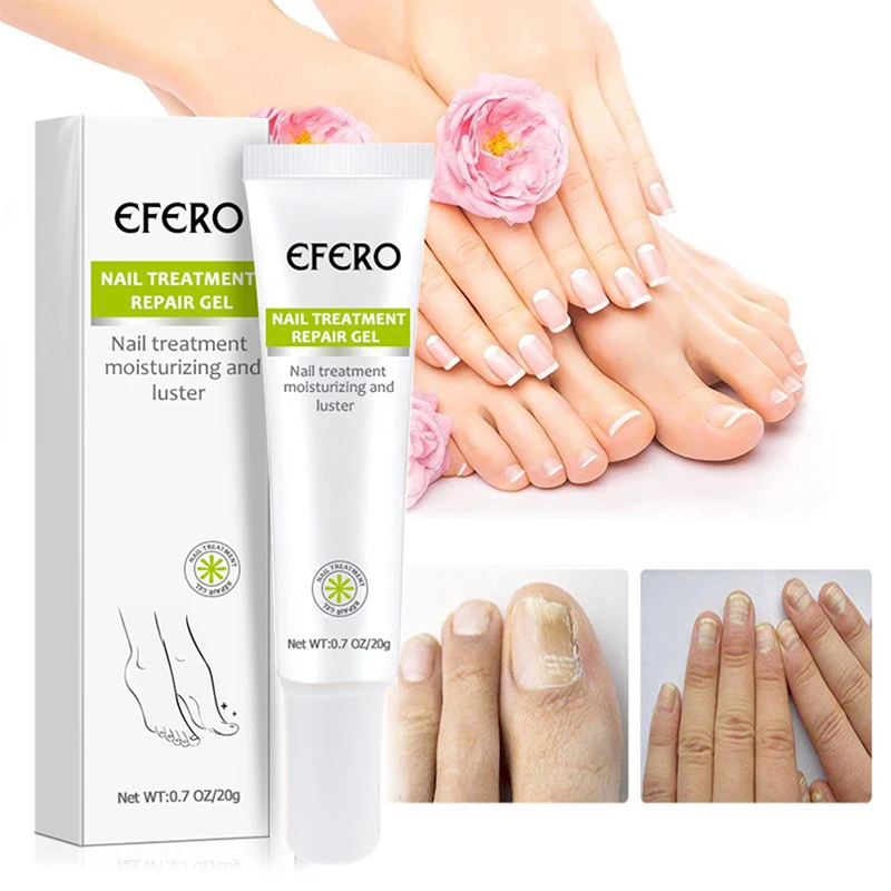 

1Pcs Anti Fungal Nail Treatment Cream Onychomycosis Nail Infection Feet Care