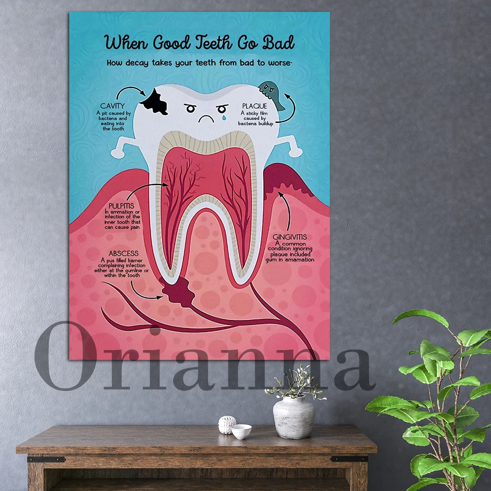 

When Good Teeth Go Bad How Decay Takes Your Teeth From Bad To Worse Canvas Poster, Dental Clinic Decor, Bad Teeth Wall Art Print