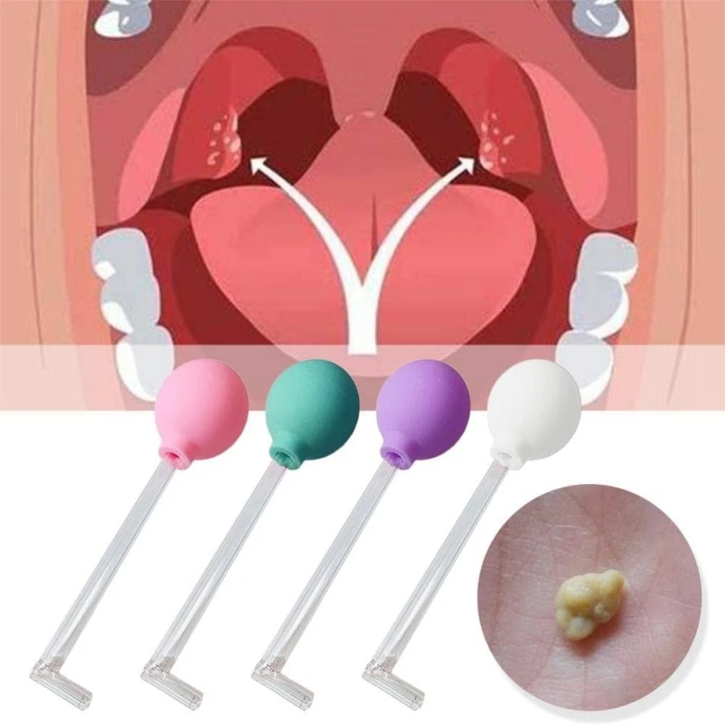 Tonsil Stone Remover Manual Style Oral Cleaner Tonsil Stone Removal Vacuum Kit Mouth Cleaning Suction Cupping Tools for Adults raizi stone slab manual edge seaming clamp assembly set for sink hole saver part tools