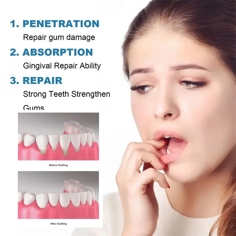 Rapid Repair Gums Serum Relieve Tooth Allergy Dental Caries Tooth Cleaning Toothpaste Relieve Damage Drops gum repair drops