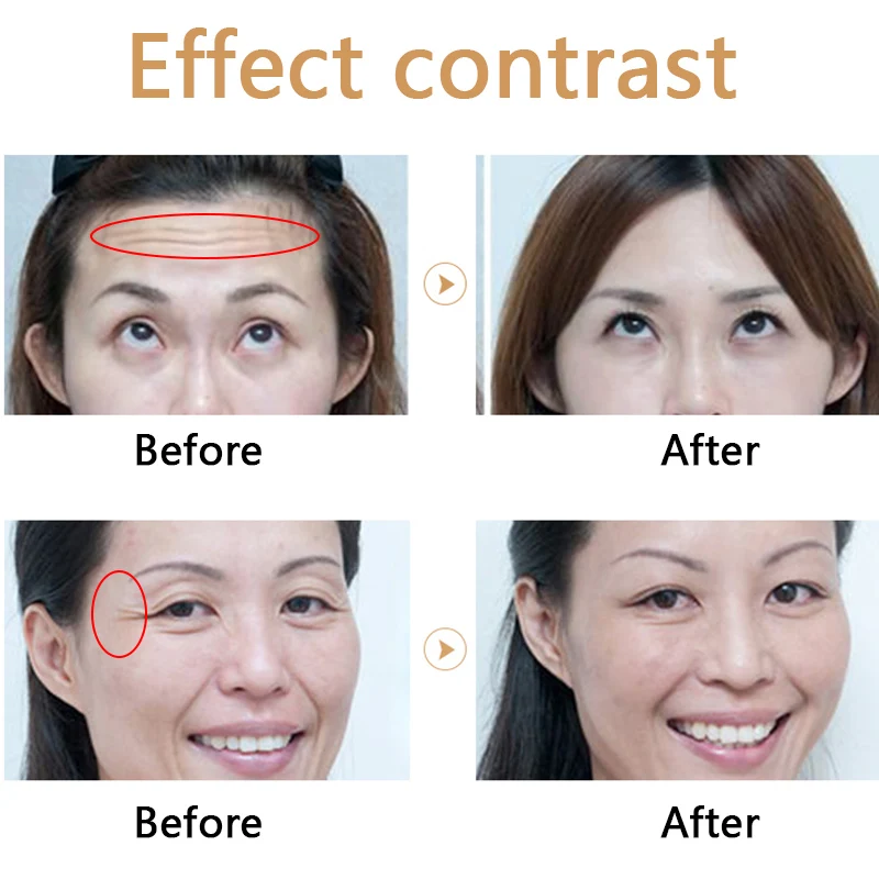 0.3/0.5ML Hyaluronic Acid Pen Tattoo Pen Safely Lip Injection Filler Collagen Instant Lip Plumper Serum Plumper Oil Lips