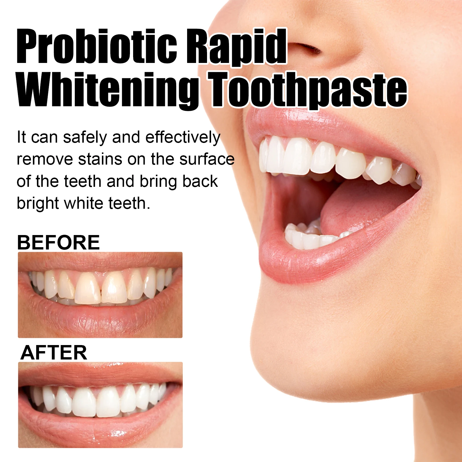 Oralhoe probiotic whitening toothpaste,Oral cleaner,Tooth Color Correction,Care For Oral Health Teeth Whitening Toothpaste