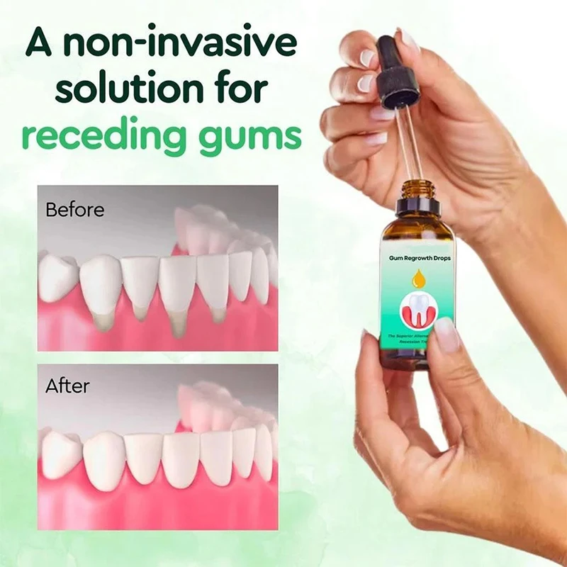 Gum Repair Drops Relieve Receding Gingival Swelling Gum Cleaning Care Oral Hygiene Remove Stain