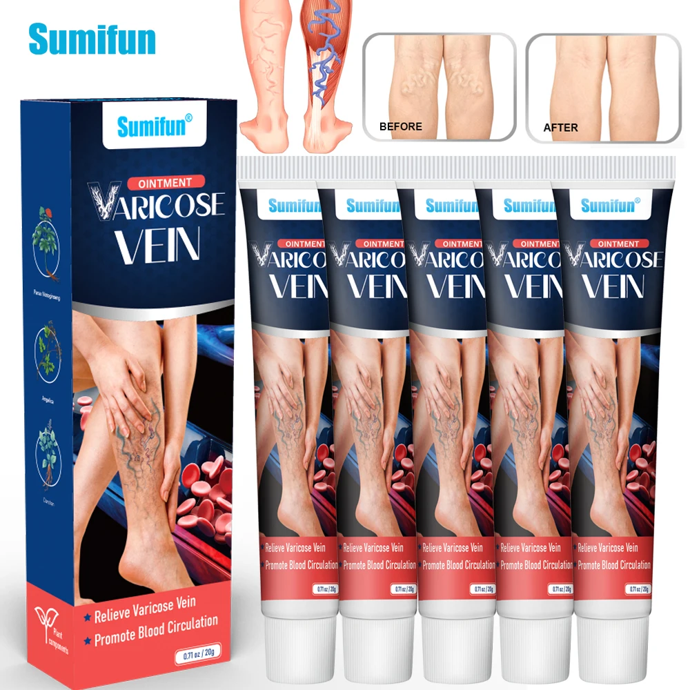 

1/5/10Pcs Sumifun Varicose Vein Cream Relieve Leg Swelling Vasculitis Phlebitis Spider Plaster Varicosity Angiitis Pain Relief