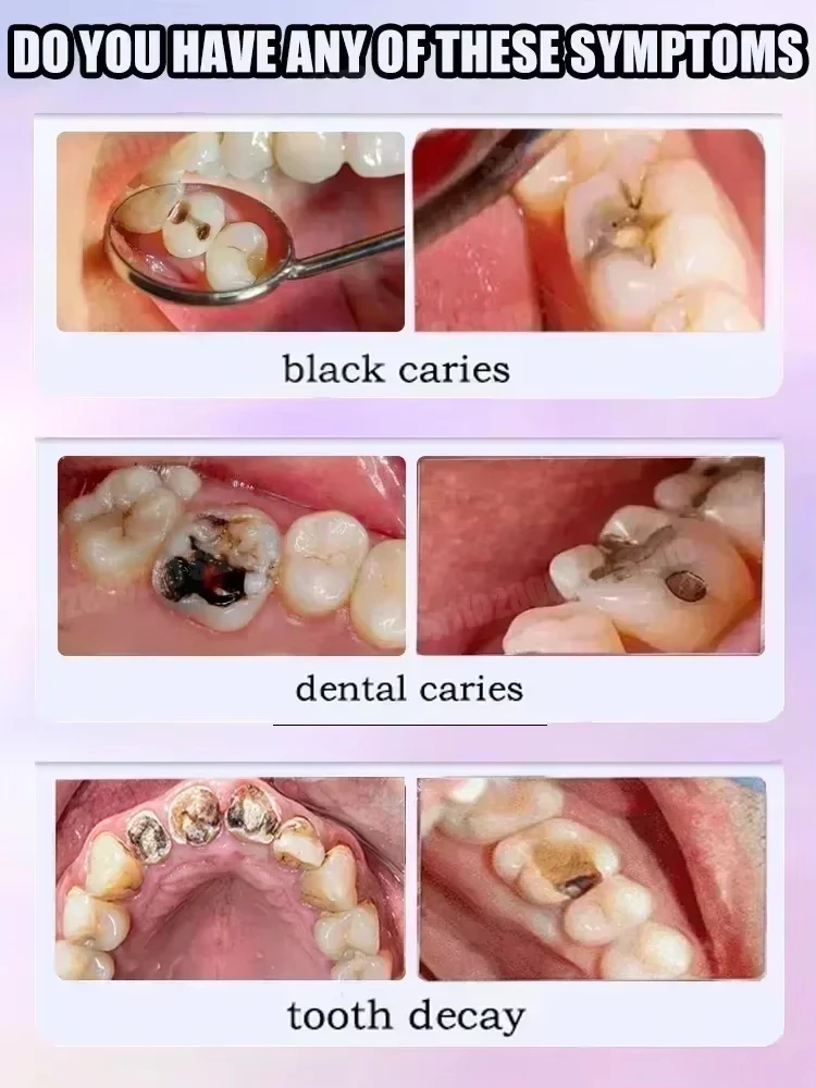 Teeth Health Product Tooth Decay Repair Cleans Plaque Whitens Teeth