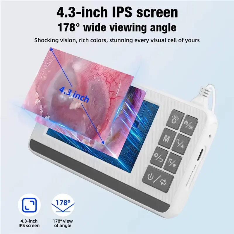 【내구성】스마트 비주얼 귀 카메라 4.3인치 이경 귀지 제거 도구는 사진 및 비디오 녹화 기능을 지원합니다.