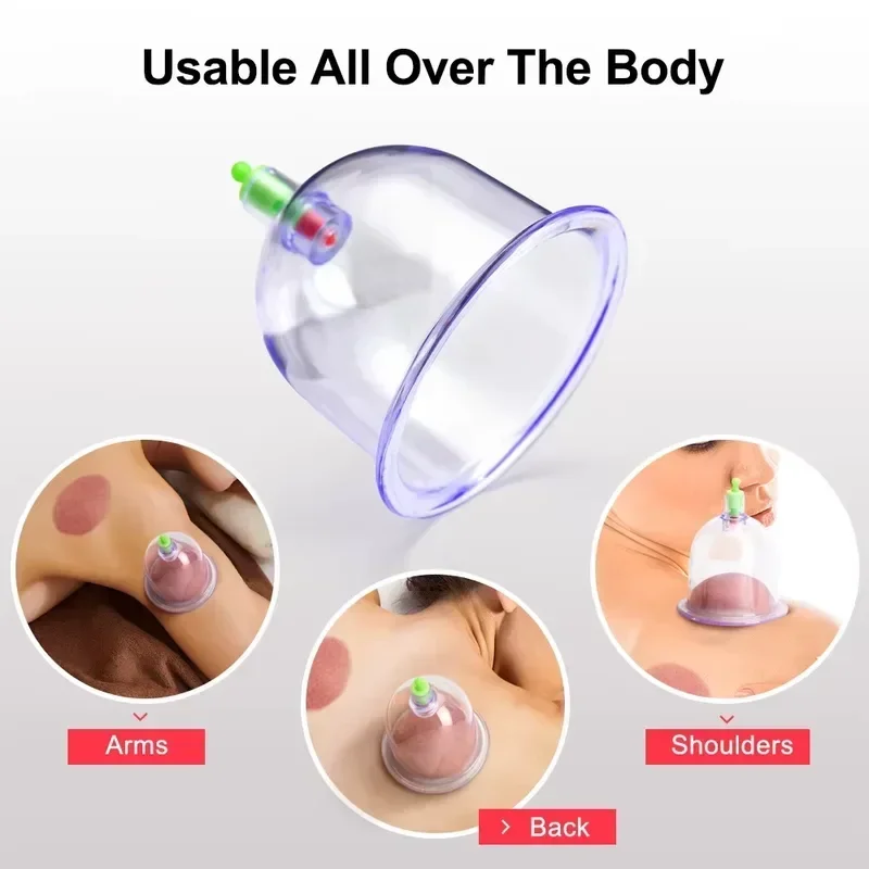 Electric Cupping Therapy Set Machine with Pump, Professional 12 Vacuum Suction Cups, Electric Universal Cupping Kit for Homeuse