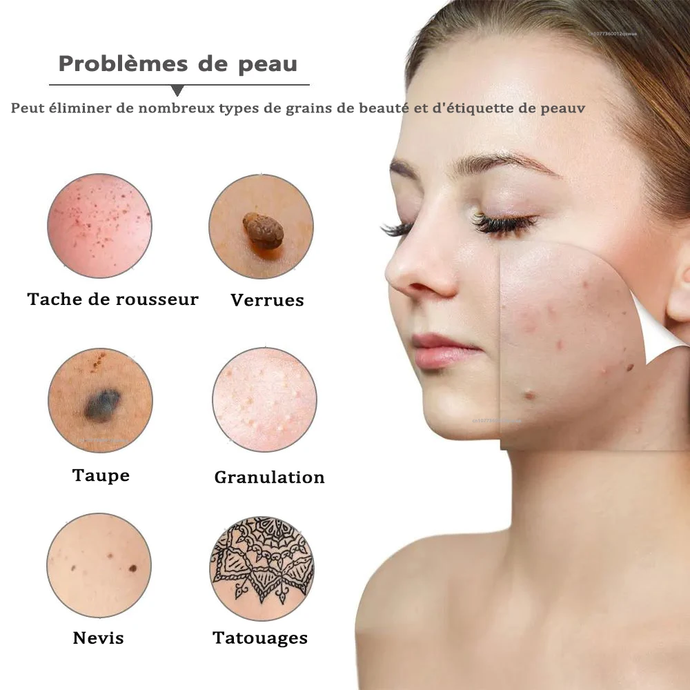 Stylo Dermique Laser/plasma - Pour Tâches De Rousseur, Grains De Beauté, Verrues - Neuf