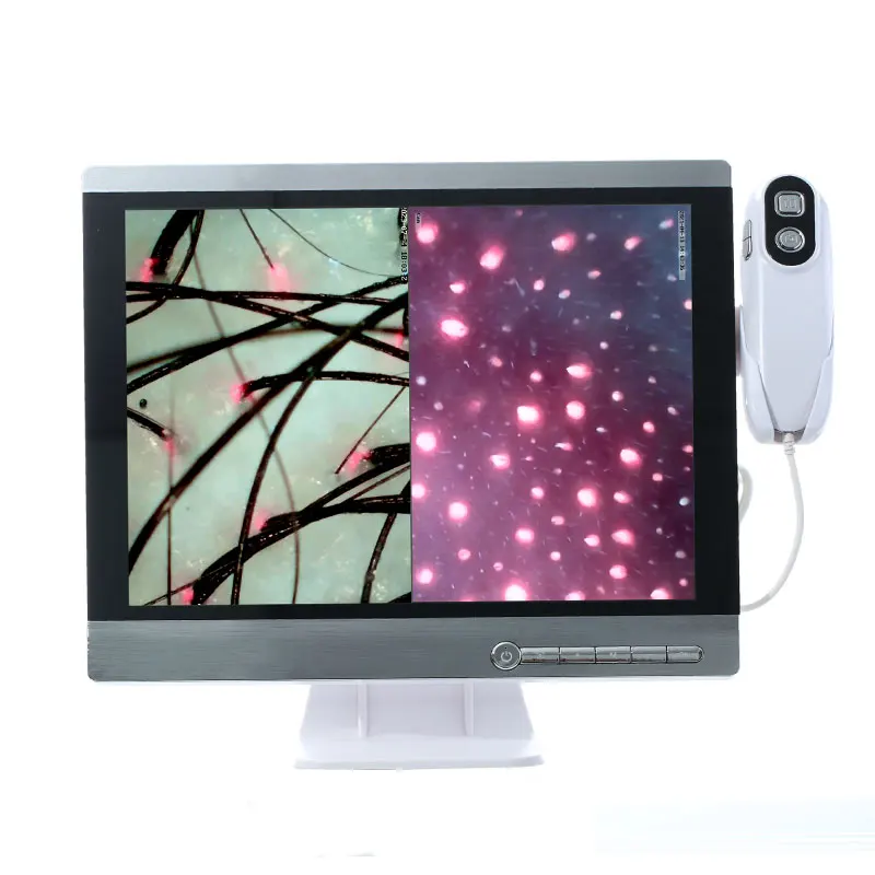 High Quality 15.5 Inch Scalp Detector Hair Test Analyzer Microscopic Skin Scalp And Hair Camera / Microscope Camera