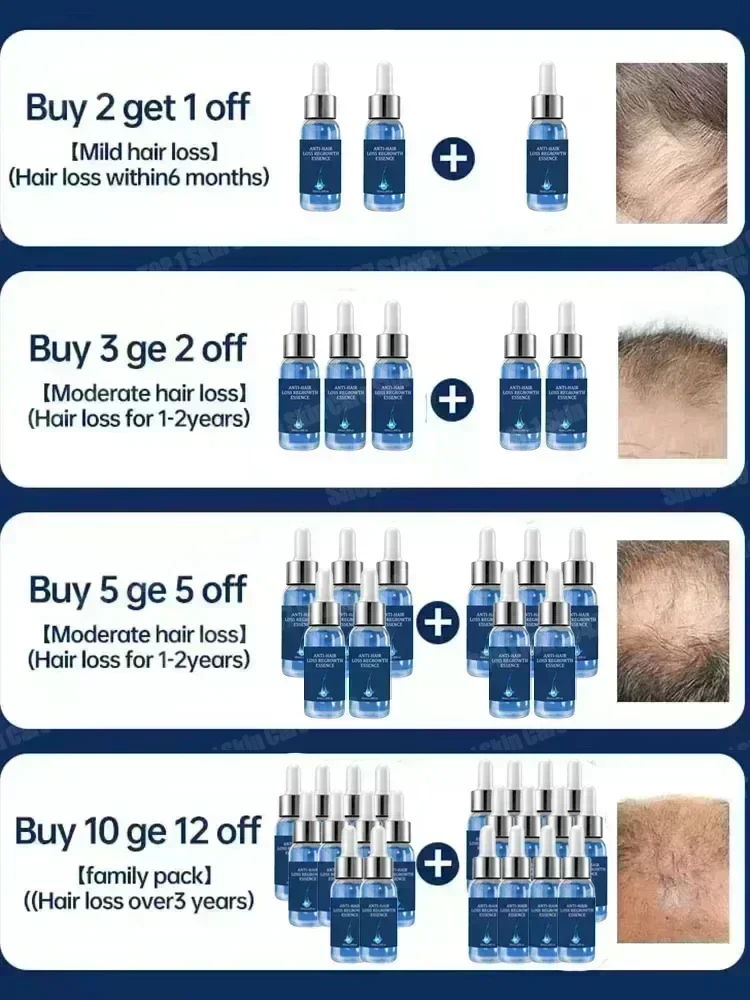 Reduces Hair Fall Nourishes the Scalp Powerful Hair Growth Serum Strengthens hair and adds shine Deeply moisturizes & nourishes