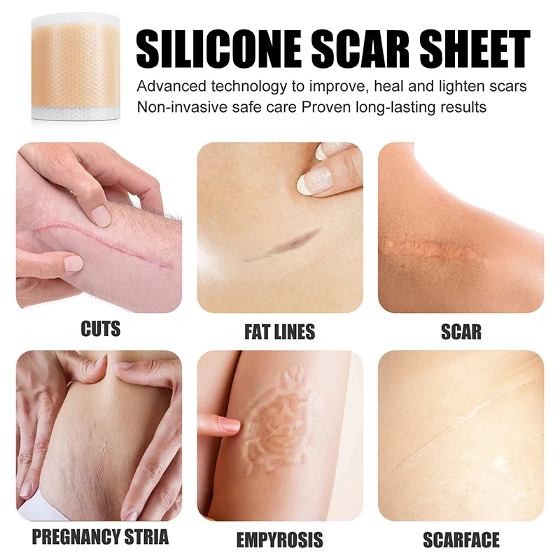 Silicone Scar Patches Removal Invisible Concealer Pad Gel Waterproof Tape Treatment for C-Section Keloid Burns Tummy Tuck