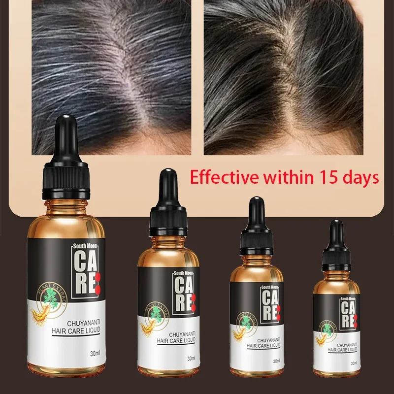 Hair care and anti hair loss essence nourishes hair roots, promotes black hair, oily hair, and is suitable for both men and wome