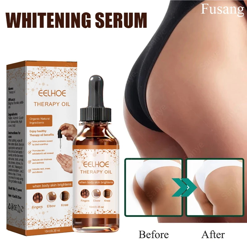 

Private Part Brightening Cream Dark Skin Whitening Essential Oil Improve Dullness Whiten Serum Underarm Joint Lightening Essence